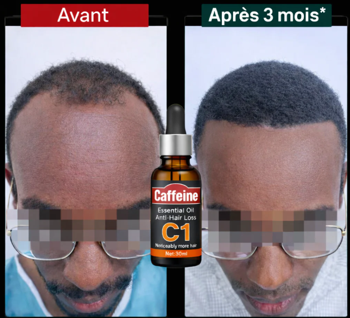 Huile Pousse Cheveux Naturelle _ Caféine C1