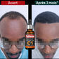 Huile Pousse Cheveux Naturelle _ Caféine C1